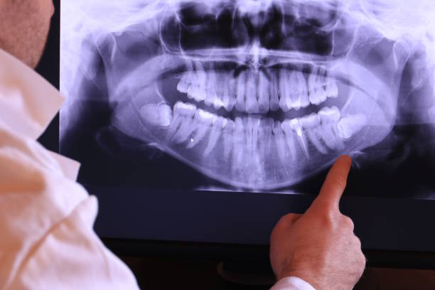 Best Emergency Cosmetic Dentistry in Cayce, SC