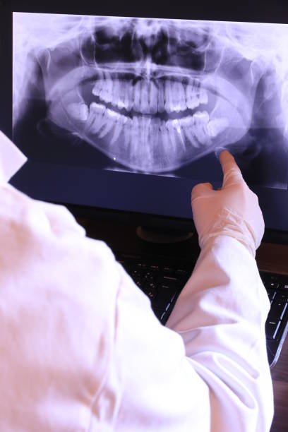 Best Emergency Dentist for Lost Fillings or Crowns in Cayce, SC